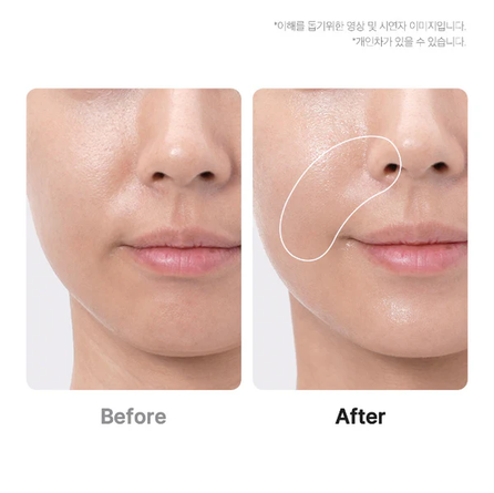 MEDICUBE Age-R Booster Pro Pink veido priežiūros prietaisas, 1 vnt.