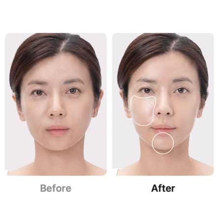 MEDICUBE Age-R Booster Pro Black veido priežiūros prietaisas, 1 vnt.