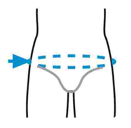 PRIM PRIM Spine Care PRS610BG nugaros (XS dydis) ortozė, 1 vnt.