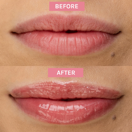 EVOLVE  Bio-Retinol Glossy Lip lūpų aliejus, 15 ml