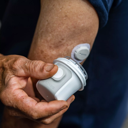 DEXCOM ONE+ Sensor (10 dienų) gliukometras, 1 vnt.