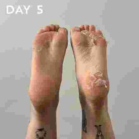 MASKOLOGY  Peeling Foot pėdų kaukė, 1 pora