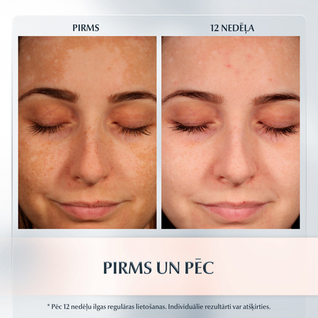 EUCERIN Anti-Pigment SPF 30 dieninis veido kremas, 50 ml